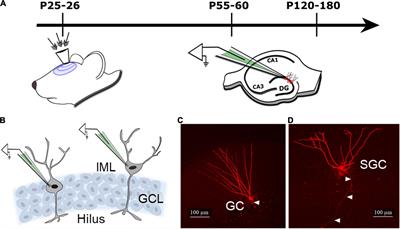 Long-Term Effects of Moderate Concussive Brain Injury During Adolescence on Synaptic and Tonic GABA Currents in Dentate Granule Cells and Semilunar Granule Cells